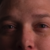 :iconrlstalder:
