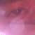 :iconrossbud: