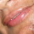 :iconsaudadedoi:
