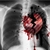 :iconscar3dh3art: