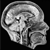:iconsensitivemutant: