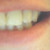 :iconshefies: