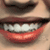 :iconshinybiebs: