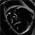 :iconshlr0w: