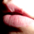 :iconskin-: