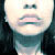 :iconsocrates-deformity: