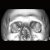 :iconsolar-gargoyle: