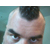 :iconSteveAnaco: