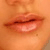 :iconsuperale: