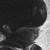 :icontack-1-1: