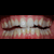 :iconthe-axeman: