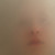 :iconthedrownedlady: