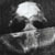 :iconthomasplunk: