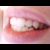 :icontitan395: