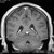 :icontorn-mind17: