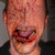 :iconvonclausen: