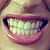 :iconwalalper: