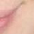 :iconxainte: