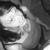 :iconxoxoxoe: