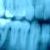 :iconxraytooth: