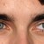 :iconyoungonekelly: