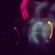 :iconyouthgone-wild: