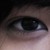 :iconzaneytology: