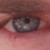 :iconzerolawless: